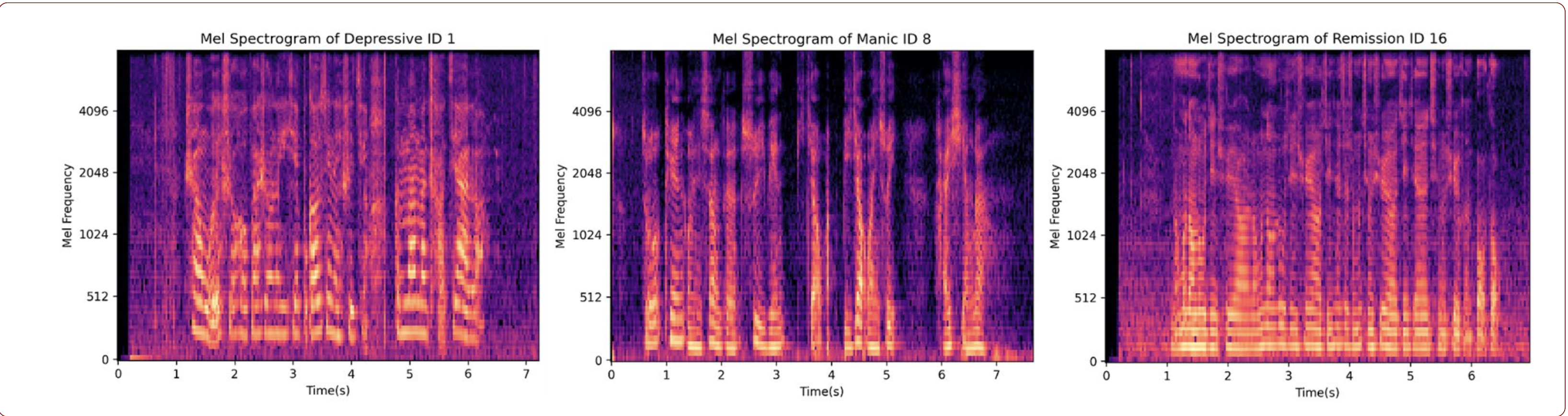 Mel spectrograms — Depressive, Manic, Remission symptom states